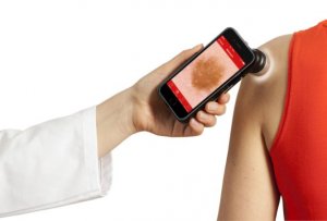 Aktuelles: handyscope für iPhone 6 Mobile Hautkrebsdiagnostik mit dem Smartphone