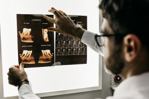 Aktuelles: Zahnwurzelbehandlung: Sinnvoll oder nicht?